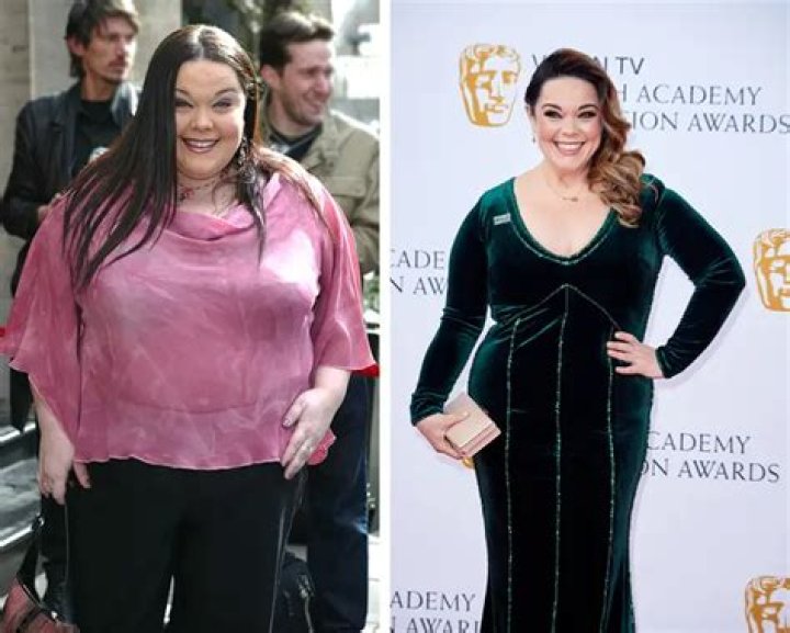 Lisa Riley | Plastic Surgery Before And After Photos